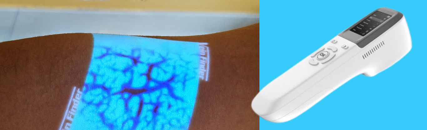 San Camillo: innovazione tecnologica per prelievi senza stress