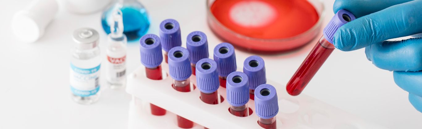 Un servizio efficiente e personalizzato per i tuoi esami di laboratorio