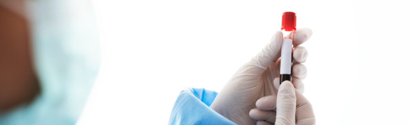 Oggi al San Camillo è possibile misurare il rischio cardiovascolare con la Lipoproteina a