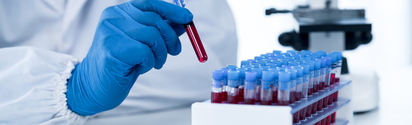 Prenditi cura del tuo domani: prenota il tuo Longevity Test