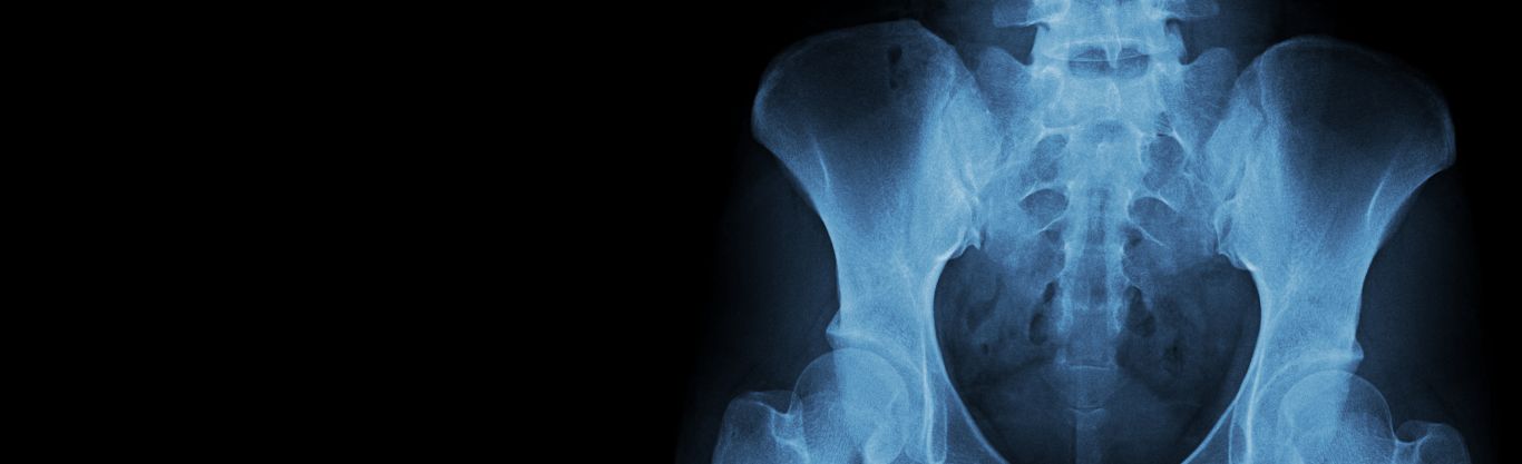 Densitometria ossea: cos’è e quando farla