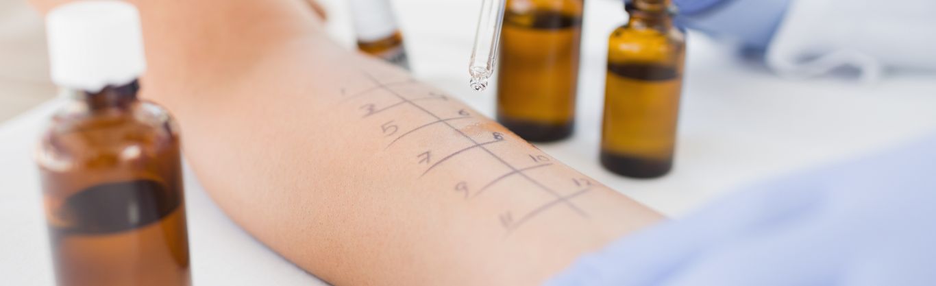 Allergie: come individuarle con il Prick Test