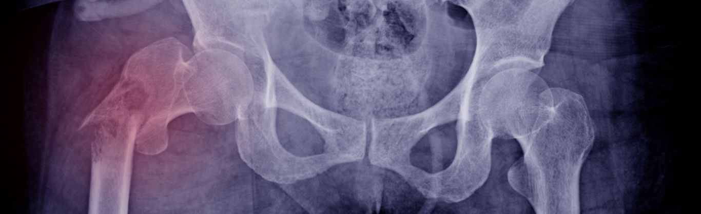 Malattie del Metabolismo osseo - gli specialisti