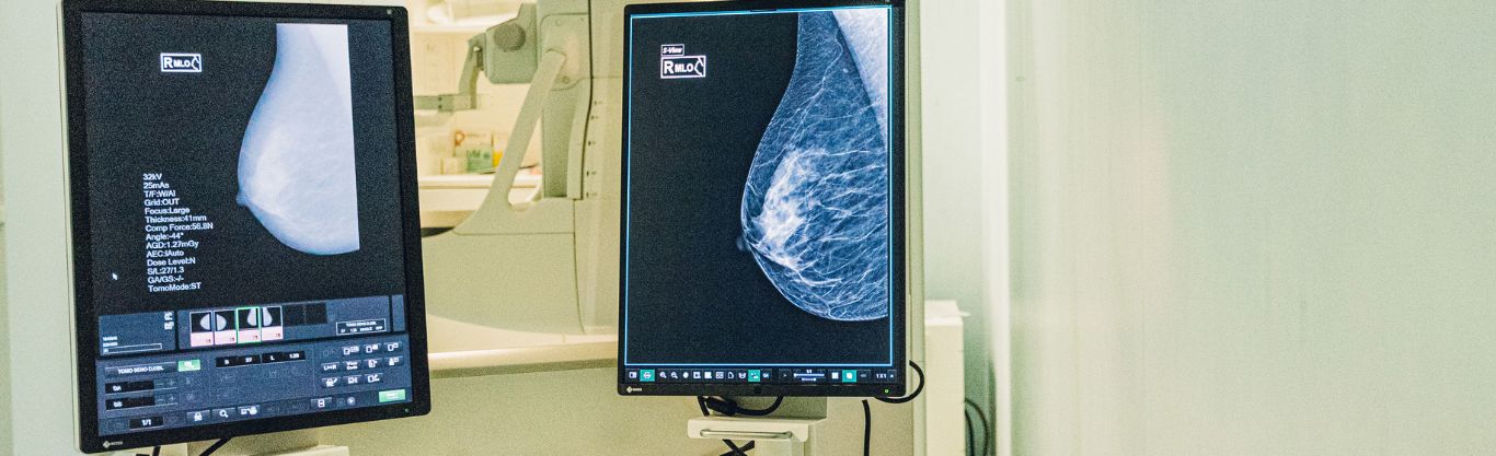 Mammografia con tomosintesi