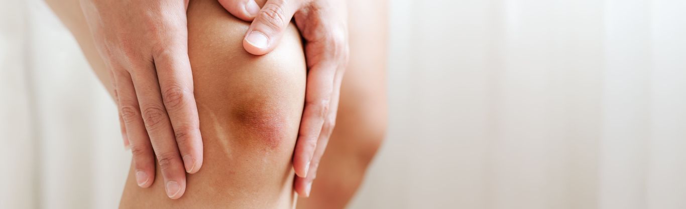 Giornata Mondiale dell’Osteoporosi: la prevenzione al San Camillo